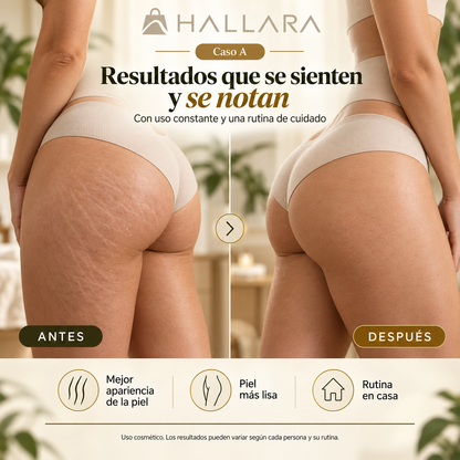 Hallara FormaLift Ultra™ - Masajeador Anticelulítico - Ordena y consigue uno 🎁 Aceite de Jenjibre 🎁